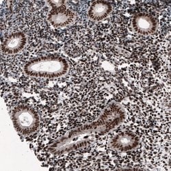 Invitrogen METTL14 Monoclonal Antibody (CL4252) 100 &mu;L; Unconjugated:Antibodies,