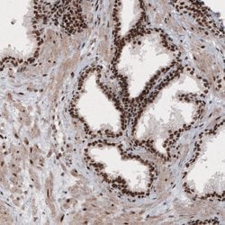 Invitrogen METTL14 Monoclonal Antibody (CL4252) 100 &mu;L; Unconjugated:Antibodies,
