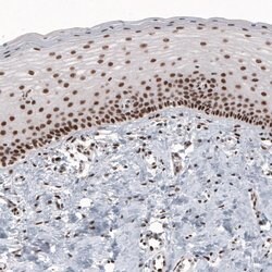 Invitrogen METTL14 Monoclonal Antibody (CL4252) 100 &mu;L; Unconjugated:Antibodies,