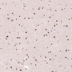 Invitrogen METTL14 Monoclonal Antibody (CL4252) 100 &mu;L; Unconjugated:Antibodies,
