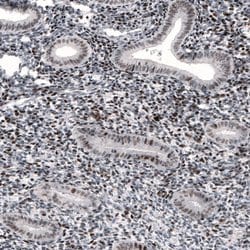 Invitrogen METTL14 Monoclonal Antibody (CL4254) 100 &mu;L; Unconjugated:Antibodies,