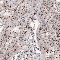 Invitrogen METTL14 Monoclonal Antibody (CL4254) 100 &mu;L; Unconjugated:Antibodies,