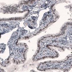 Invitrogen METTL14 Monoclonal Antibody (CL4254) 100 &mu;L; Unconjugated:Antibodies,