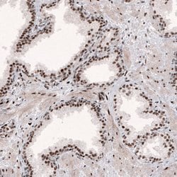 Invitrogen METTL14 Monoclonal Antibody (CL4254) 100 &mu;L; Unconjugated:Antibodies,