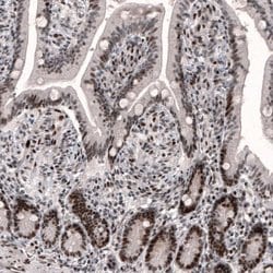 Invitrogen METTL14 Monoclonal Antibody (CL4254) 100 &mu;L; Unconjugated:Antibodies,