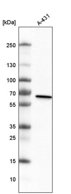 Invitrogen METTL14 Monoclonal Antibody (CL4254) 100 &mu;L; Unconjugated:Antibodies,