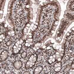 Invitrogen SMCHD1 Monoclonal Antibody (CL4270) 100 &mu;L; Unconjugated:Antibodies,