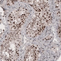 Invitrogen SMCHD1 Monoclonal Antibody (CL4270) 100 &mu;L; Unconjugated:Antibodies,