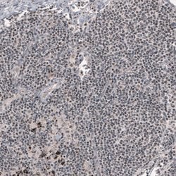 Invitrogen SMCHD1 Monoclonal Antibody (CL4270) 100 &mu;L; Unconjugated:Antibodies,
