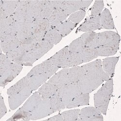 Invitrogen SMCHD1 Monoclonal Antibody (CL4270) 100 &mu;L; Unconjugated:Antibodies,