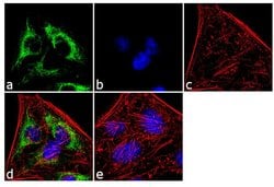 Invitrogen Cytokeratin 7 Monoclonal Antibody (OV-TL 12/30) 500 &mu;L; Unconjugated:Antibodies,