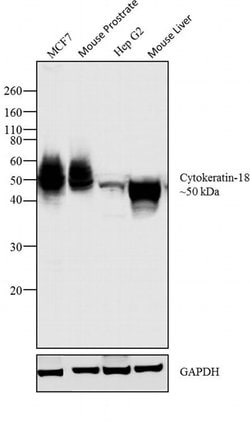 Invitrogen Cytokeratin 18 Monoclonal Antibody (DC10) 500 &mu;L; Unconjugated:Antikroppar
