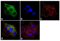 Invitrogen Cytokeratin 19 Monoclonal Antibody (BA17) 500 &mu;L | Buy Online | Invitrogen&trade; | Fisher Scientific