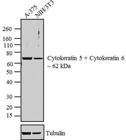 Invitrogen Cytokeratin 5/6 Monoclonal Antibody (D5/16 B4) 500 &mu;L; Unconjugated:Antibodies,
