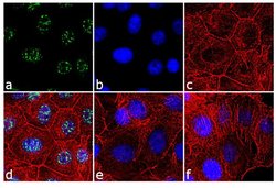 Phospho-Rb (Ser608) Monoclonal Antibody (51B7), Invitrogen 500 &mu;L | Buy Online | Invitrogen | Fisher Scientific