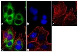 Invitrogen&trade;&nbsp;Cytokeratin 19 Monoclonal Antibody (A53-B/A2.26 (Ks19.1))