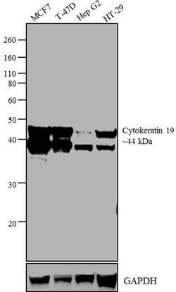 Invitrogen Cytokeratin 19 Monoclonal Antibody (A53-B/A2.26 (Ks19.1)) 500 &mu;L | Buy Online | Invitrogen&trade; | Fisher Scientific