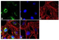TIMP1 Monoclonal Antibody (102D1), Invitrogen 500 &mu;L; Unconjugated:Antibodies,