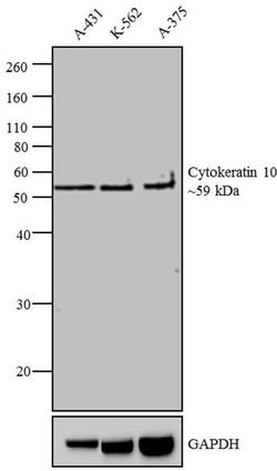 Invitrogen Cytokeratin 10 Monoclonal Antibody (DE-K10) 500 &mu;L; Unconjugated:Antibodies,