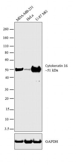 Cytokeratin 16 Monoclonal Antibody (LL025), Invitrogen 500 &mu;L | Buy Online | Invitrogen | Fisher Scientific