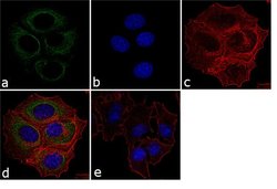 p73 Monoclonal Antibody (ER-15), Invitrogen 500 &mu;L; Unconjugated:Antibodies,