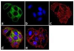Cytokeratin 18 Monoclonal Antibody (E431-1), Invitrogen 1 mL; Unconjugated:Antibodies,