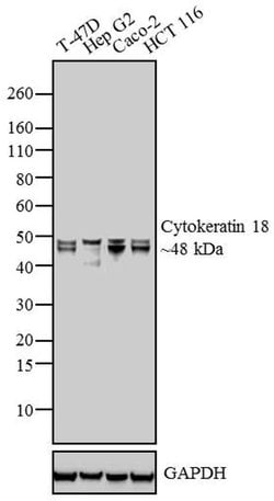 Cytokeratin 18 Monoclonal Antibody (E431-1), Invitrogen 1 mL; Unconjugated:Antibodies,
