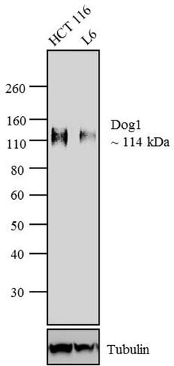 Invitrogen DOG-1 Recombinant Rabbit Monoclonal Antibody (SP31) 1 mL | Buy Online | Invitrogen&trade; | Fisher Scientific