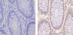 Glucocorticoid Receptor Monoclonal Antibody (6E6), Invitrogen 100 &mu;L;