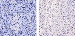 Glucocorticoid Receptor Monoclonal Antibody (6E6), Invitrogen 100 &mu;L;