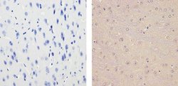 Glucocorticoid Receptor Monoclonal Antibody (6E6), Invitrogen 100 &mu;L;