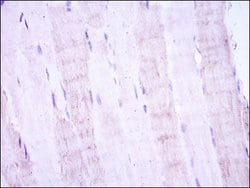 Invitrogen MAP2K4 Monoclonal Antibody (5H4) 100 &mu;L; Unconjugated:Antibodies,