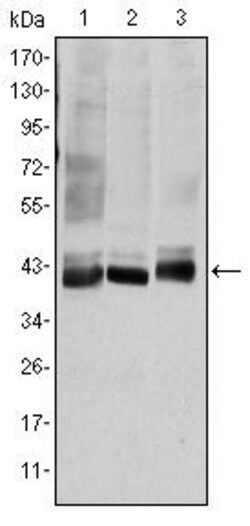 Invitrogen MAP2K4 Monoclonal Antibody (5H4) 100 &mu;L; Unconjugated:Antibodies,