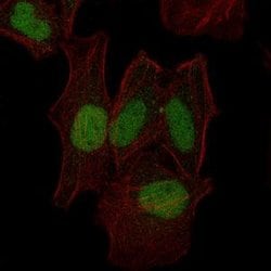 Invitrogen MEK7 Monoclonal Antibody (4E5) 100 &mu;L; Unconjugated:Antibodies,