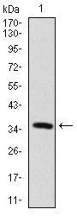 Invitrogen MAP2 Monoclonal Antibody (5B7) 100 &mu;g; Unconjugated:Antibodies,