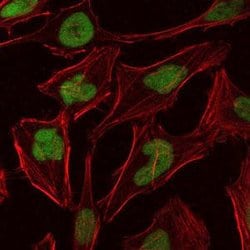 Invitrogen MCM2 Monoclonal Antibody (1E7) 100 &mu;L; Unconjugated:Antibodies,