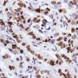 Invitrogen MCM2 Monoclonal Antibody (SP85) 500 &mu;L; Unconjugated:Antibodies,