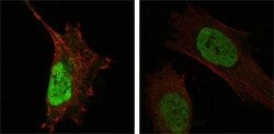 Invitrogen MDMX Monoclonal Antibody (2D10F4) 100 &mu;L; Unconjugated:Antibodies,