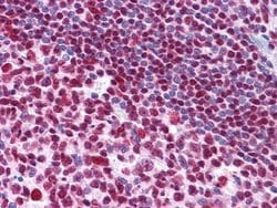 Invitrogen MDMX Monoclonal Antibody (2D10F4) 100 &mu;L; Unconjugated:Antibodies,