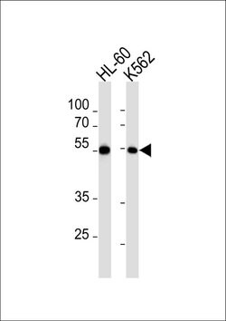MEF2C Polyclonal Antibody, Invitrogen 400 &mu;L; Unconjugated:Antibodies,