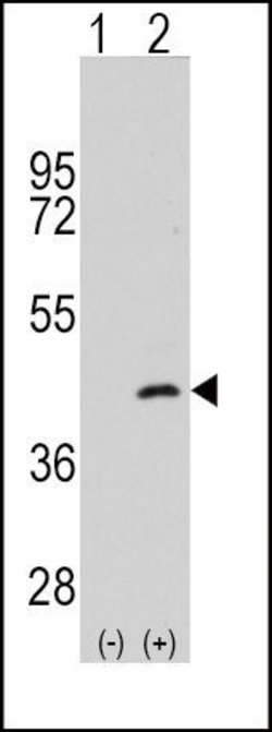 SEK1 Rabbit anti-Human, Polyclonal, Invitrogen 400 &mu;L; Unconjugated:Antibodies,