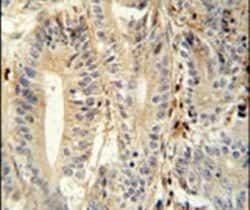 MEP1A Polyclonal Antibody, Invitrogen 400 &mu;L; Unconjugated:Antibodies