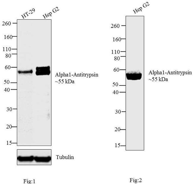 alpha1 Antitrypsin Monoclonal Antibody (TMF14B5), Invitrogen 1 mg