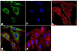Invitrogen Follicle Stimulating Hormone Monoclonal Antibody (P2H3) 1 mg;