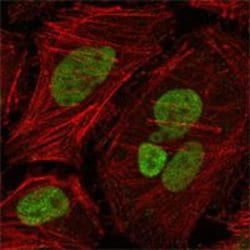 Invitrogen MLH1 Monoclonal Antibody (4C9C7) 100 &mu;L; Unconjugated:Antibodies,