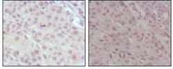 Invitrogen HRX Monoclonal Antibody (10F8D7) 100 &mu;L; Unconjugated:Antibodies,