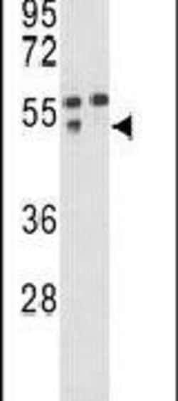 MMP12 Polyclonal Antibody, Invitrogen 400 &mu;L; Unconjugated:Antibodies,