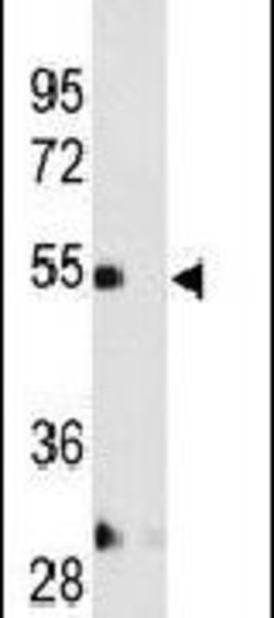 MMP12 Polyclonal Antibody, Invitrogen 400 &mu;L; Unconjugated:Antibodies,