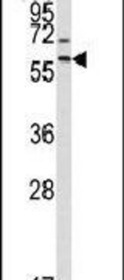MMP17 Rabbit anti-Human, Polyclonal, Invitrogen 400 &mu;L; Unconjugated:Antibodies,