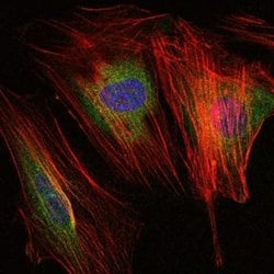 Invitrogen MMP9 Monoclonal Antibody (5G3) 100 &mu;L; Unconjugated:Antibodies,